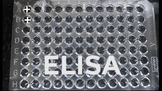 ELISA  How to do ELISA  step by step procedure for ELISA [upl. by Skees]