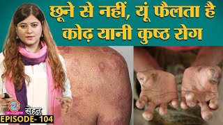 कुष्ठ रोग यानी Leprosy किसे और कैसे हो सकता है यहां जान लीजिए  Sehat ep 104 [upl. by Eilraep817]