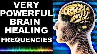 EXTREME BRAIN HEALING FREQUENCIES FOR STUDY FOCUS MIND POWER CONFIDENCE MEDITATION  MUST TRY [upl. by Athenian]