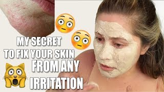 GET RID OF SKIN RASHES ON FACE  Allergic reaction [upl. by Orianna]