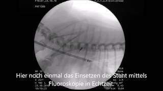 Trachealkollaps des Hundes  Diagnose amp Therapie [upl. by Ellenrahs]