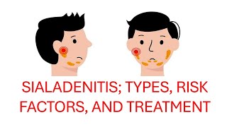 Understanding Sialadenitis Types Acute and Chronic Risk Factors and Treatment Options [upl. by Attenej]