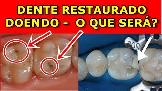 Dente Restaurado Doendo  O que pode ser O que fazer [upl. by Alisia]