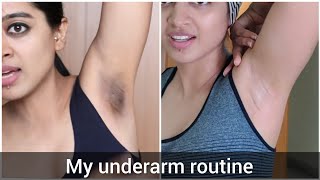 How I Got Rid of My Dark Underarms [upl. by Hanaj590]