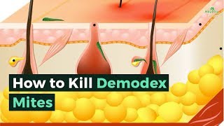 How to Kill Demodex Mites [upl. by Kobi]