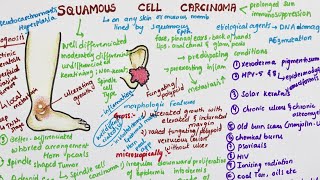 Squamous Cell Carcinoma  Pathology [upl. by Publius]