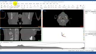 How to Import DICOM Images into Mimics  Mimics Innovation Suite [upl. by Hessler41]