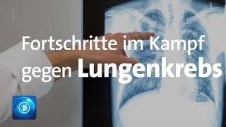 Lungenkrebs 3 Fragen 3 Antworten  Asklepios [upl. by Eadwina]