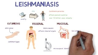 What is Leishmaniasis An introduction and overview [upl. by Notlrahc780]