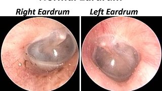 Labyrinth Structure and inner ear function preview  Human Anatomy  Kenhub [upl. by Hnirt]