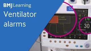 Ventilator Basics for ICU I [upl. by Desta638]