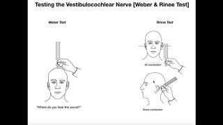 Interpreting the WeberRinne Tests EXPLAINED [upl. by Etty]