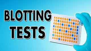 Blotting Techniques Western Blot Southern Blot and Northern Blot [upl. by Adnomal]