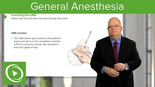 General Anesthesia – Anesthesiology  Lecturio [upl. by Anilys]