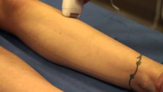 Epilator vs Waxing  Waxing Tips amp Tricks [upl. by Gabriella]