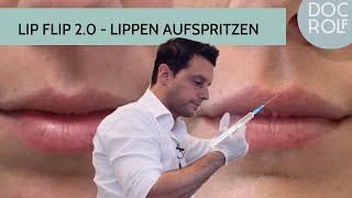 LIPPEN AUFSPRITZEN mit HYALURON amp BOTOX  der LIP FLIP 20 [upl. by Aigroeg996]