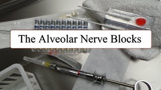 The Alveolar Nerve Blocks [upl. by Ardnuasac]