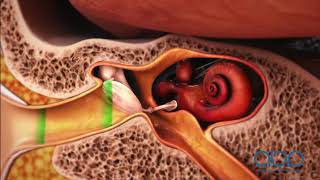 How the Ear Works  3D Medical Animation  ABP © [upl. by Higgins]