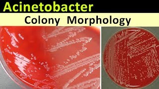 Acinetobacter Colony Morphology [upl. by Thibault380]