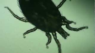 Dermatology Dermatophagoides pteronyssinus House Dust Mite [upl. by Atteinotna]