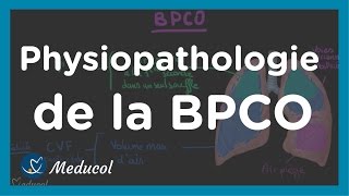 Emphysème pulmonaire et BPCO physiopathologie et causes [upl. by Hera]