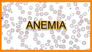 Anemia Types Findings Lab Values [upl. by Ninel]