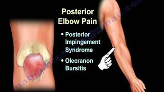 ELBOW PAIN  COMMON CAUSES  Everything You Need To Know  Dr Nabil Ebraheim [upl. by Emiaj]