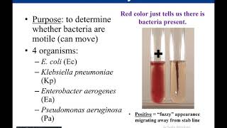 GI Motility Part  1  Chewing Reflex  Deglutition  Gastrointestinal Physiology [upl. by Anirtap]