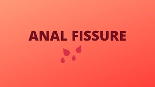 Anal Fissure  DefintionTypesCausesSigns amp SymptomsDiagnosisTreatment [upl. by Kitty870]