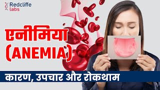 Anemia Symptoms Causes And Treatment In Hindi  शरीर में खून की कमी यानी Anemia कितना ख़तरनाक है [upl. by Tor]