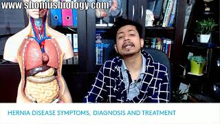 Hernia symptoms test diagnosis and surgery  Hernia kya hota hai Hindi mein [upl. by Sello924]