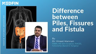 What is the difference between Piles Fissures and Fistula [upl. by Nieberg]