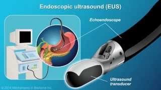 Understanding EUSFNA [upl. by Enrev]