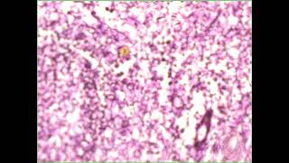 Loose c t  reticular Lymphnode reticulin stain [upl. by Enyaw]