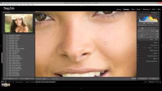 How to Quickly Clean Up Blemishes in Lightroom [upl. by Nick]