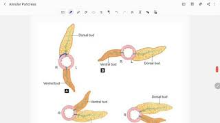 Annular Pancreas [upl. by Naik238]