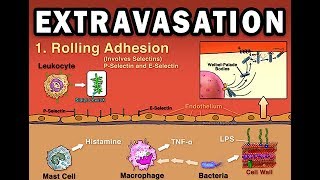 EXTRAVASATION [upl. by Levesque]