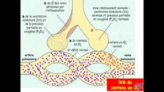 Semiologie de linsuffisance respiratoire Partie 1 [upl. by Hcurob]