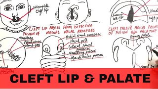 Embryology of the Face Easy to Understand [upl. by Ungley108]