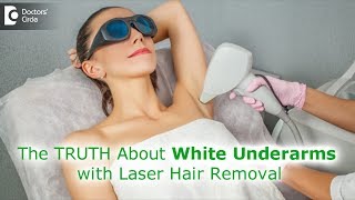 Myth or Fact Can laser hair removal procedure whiten underarmsDr Rashmi RavindraDoctors Circle [upl. by Ahserb]