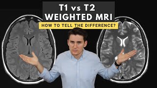 T1 vs T2 weighted MRI images How to tell the difference [upl. by Mcnair]