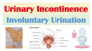 What Causes Blood in Urine  Cxbladder [upl. by Ailerua]