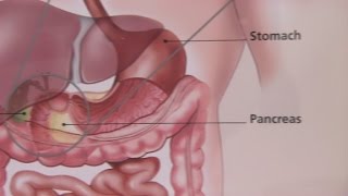 Irritable Bowel Syndrome amp Its Symptoms [upl. by Bouchier441]