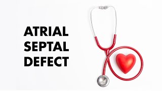 Sinus Venosus Atrial Septal Defect [upl. by Gretal]