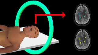 PET Scan  How It Works  Animation [upl. by Nowahs904]