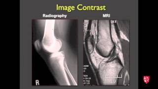 Medical Student Lecture Introduction to Musculoskeletal Imaging [upl. by Vanzant576]