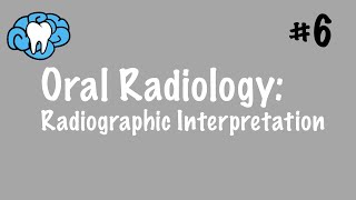 Oral Radiology  Radiographic Interpretation  INBDE ADAT [upl. by Joris]