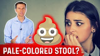 What Does PaleColored Poop Mean – DrBerg [upl. by Trudy803]