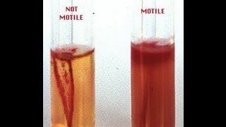 Gastrointestinal  GI Motility of the Esophagus amp Stomach [upl. by Meesan433]