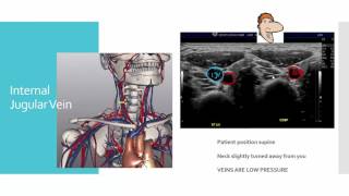 Upper Extremity Venous tutorial1 [upl. by Anairo]